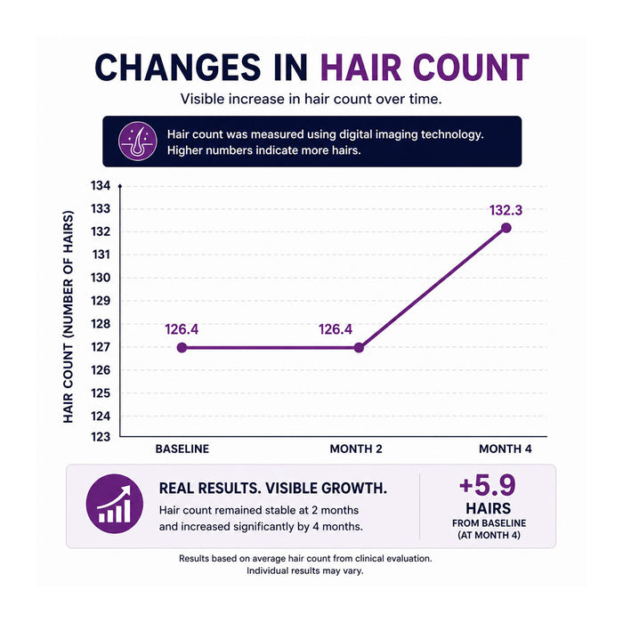 FOLIGAIN® Women's Hair Regrowth Kit with TRIOXIDIL® 10% and Minoxidil 2%