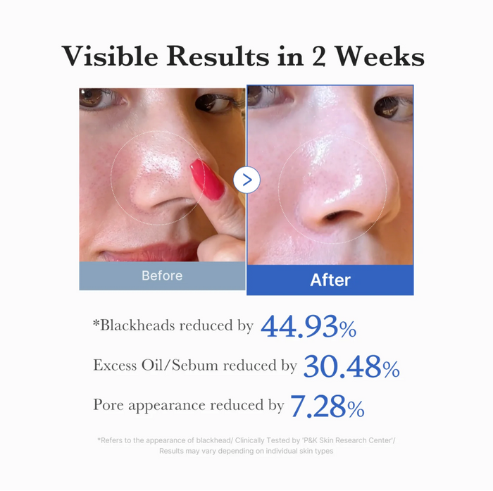 Medicube Zero Pore Pads