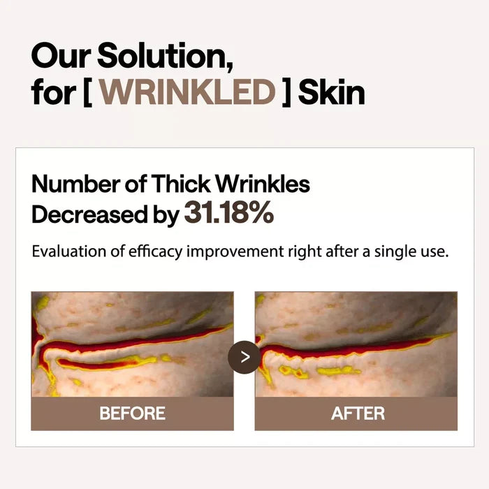 Retinol Collagen Ampoule Patch